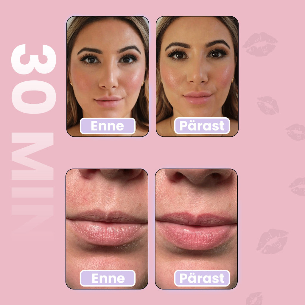 LipSeal Patch™ - Instant lip filler